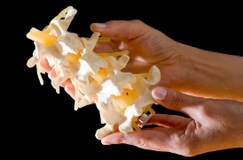 Back Pain Symptoms Back Pain Symptoms